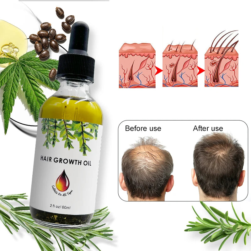 Scalp Japanese Onion Hair Fall Biotin Wholesale Babies Rosemary Oil Batana Oil Hair Treatment Set Hair Growth Oil