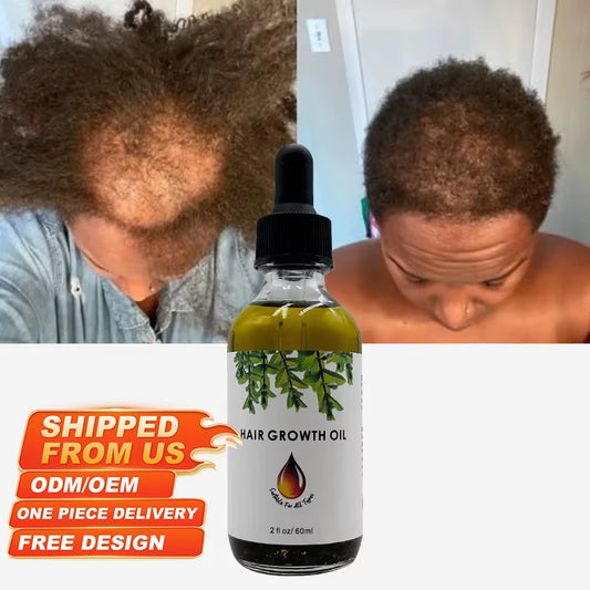 Scalp Japanese Onion Hair Fall Biotin Wholesale Babies Rosemary Oil Batana Oil Hair Treatment Set Hair Growth Oil